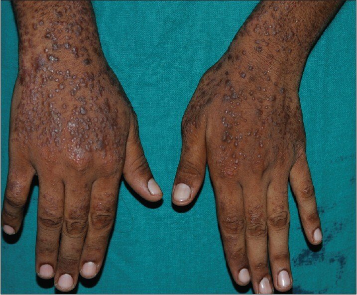 Vimla Skin Clinic