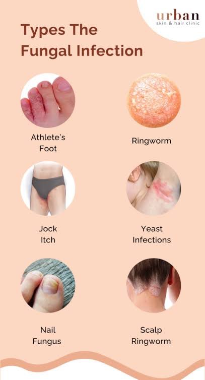 Vimla Skin Clinic